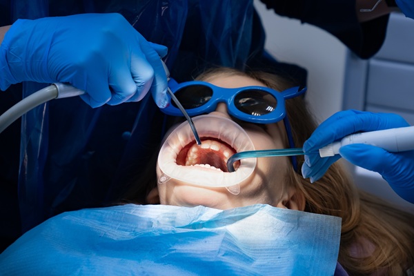 The Complete Process Of Full Mouth Reconstruction Explained